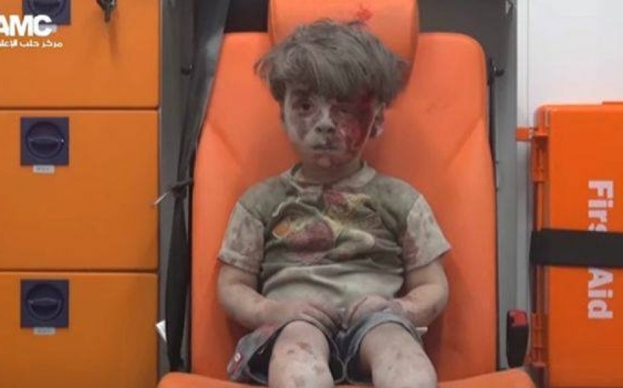 Συρία: Πώς είναι σήμερα ο 5χρονος από το Χαλέπι που είχε συγκλονίσει μετά από τον βομβαρδισμό
