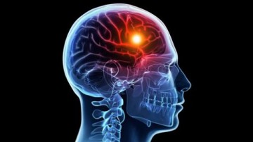 Πέντε προειδοποιητικά σημάδια εγκεφαλικού που μπορεί να περάσουν απαρατήρητα