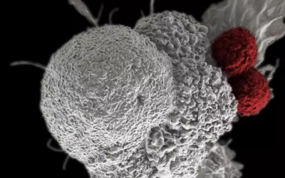 Επαναστατικό τεστ ανιχνεύει τον καρκίνο ακόμα και χωρίς συγκεκριμένα συμπτώματα – Πως λειτουργεί