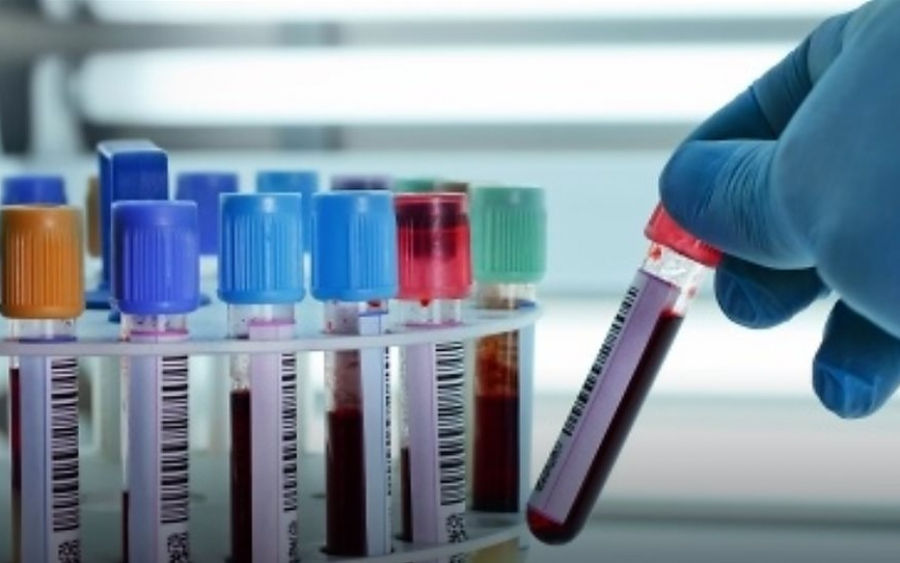 Μικροβιολογικό εργαστήριο στην Κεφαλονιά αναζητά προσωπικό