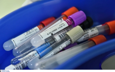 Κορονοϊός: 35 νέα κρούσματα στην Ελλάδα! Στους πέντε οι νεκροί