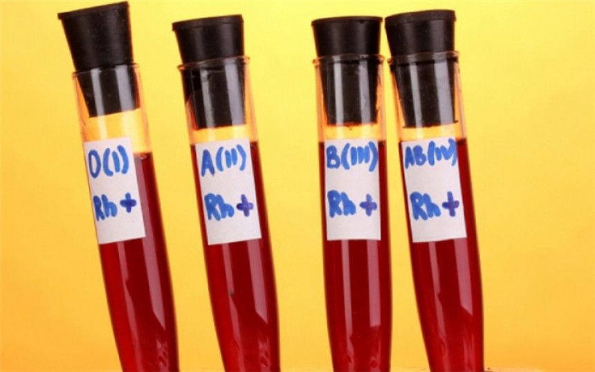Τι δείχνει η ομάδα αίματος για την υγεία σας