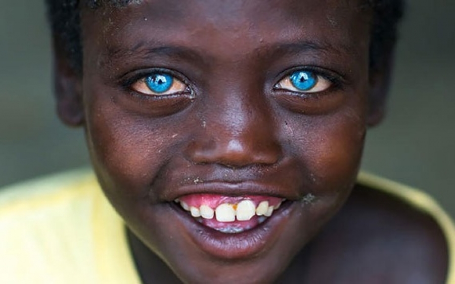 Aγόρι από την Αφρική με καταγάλανα μάτια!