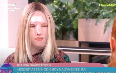 Συγκινεί η Ιωάννα Παλιοσπύρου: Η πρώτη φωτογραφία χωρίς τη μάσκα και το μήνυμα στη γιατρό της (video)