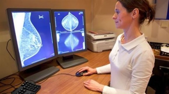 Καρκίνος Μαστού: Όσο γρηγορότερα η θεραπεία, τόσο καλύτερη η επιβίωση