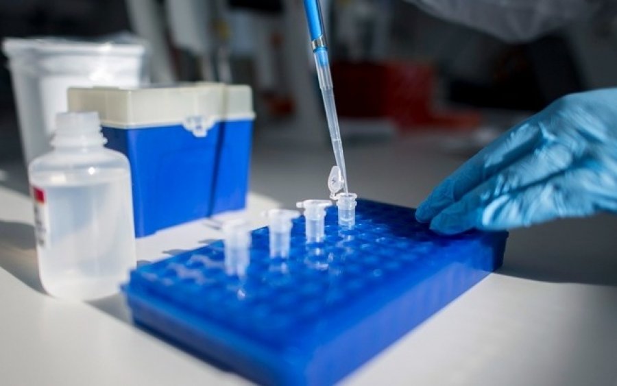 Χρειάζεται το τεστ αντισωμάτων για να δούμε αν «δούλεψε» το εμβόλιο – Τι λένε οι επιστήμονες