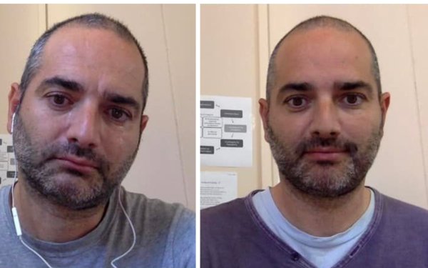 Χρόνης Πολίτσης: "Όχι άλλος εκφοβισμός στα άτομα με αναπηρία..."
