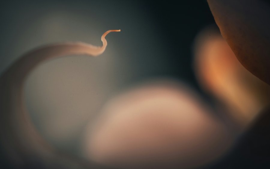 18 παιδιά στην Ελλάδα από τον δότη με την καρκινογόνα μετάλλαξη: Ανησυχία για τα κενά ασφαλείας