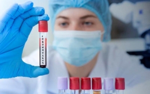 Ενημέρωση πολιτών για τον κορονοϊό και την εφαρμογή των μέτρων αντιμετώπισης του στα Ιόνια Νησιά