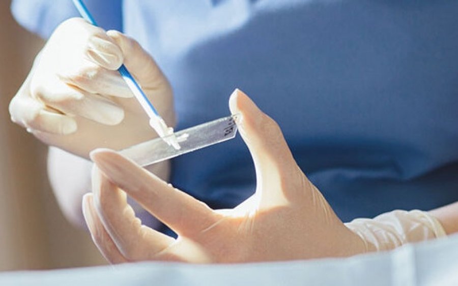 Ξεκινούν Test Pap στο Μαντζαβινάτειο Νοσοκομείο