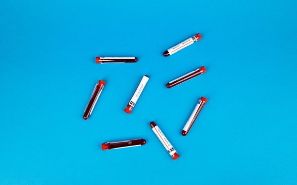 Απλή εξέταση αίματος μπορεί να προβλέψει τη νόσο του Crohn χρόνια πριν την εμφάνιση συμπτωμάτων