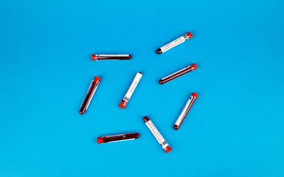 Απλή εξέταση αίματος μπορεί να προβλέψει τη νόσο του Crohn χρόνια πριν την εμφάνιση συμπτωμάτων