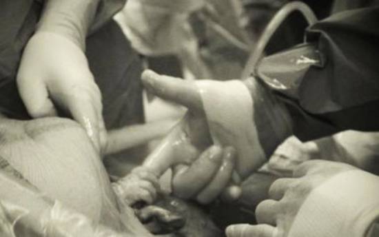 Η φωτογραφία με το έμβρυο που κάνει το γύρο του Διαδικτύου και συγκλονίζει