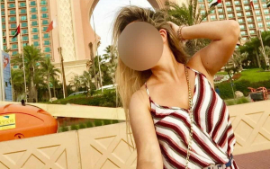 Επίθεση με βιτριόλι: Ποινική Δίωξη στην 35χρονη για απόπειρα ανθρωποκτονίας από πρόθεση