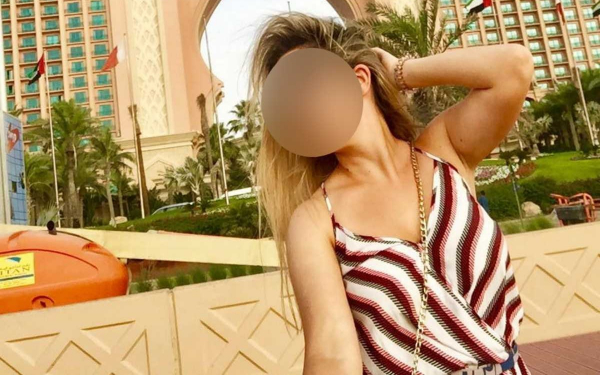 Επίθεση με βιτριόλι: Ποινική Δίωξη στην 35χρονη για απόπειρα ανθρωποκτονίας από πρόθεση