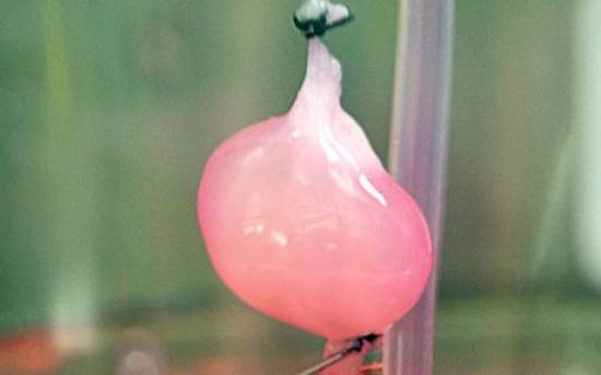 Νέες ελπίδες γεννά η “αναγέννηση” νεφρού στο εργαστήριο