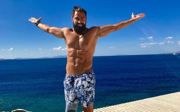 Μιχάλης Σεΐτης: Πριν 5 χρόνια ακρωτηριάστηκε το πόδι μου, το είδα σαν την τυχερή μου μέρα