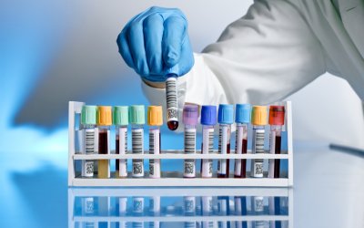 Έναρξη εγγραφών Σχολής Ανωτέρας Επαγγελματικής Κατάρτισης Γ.Ν. Κεφαλληνίας
