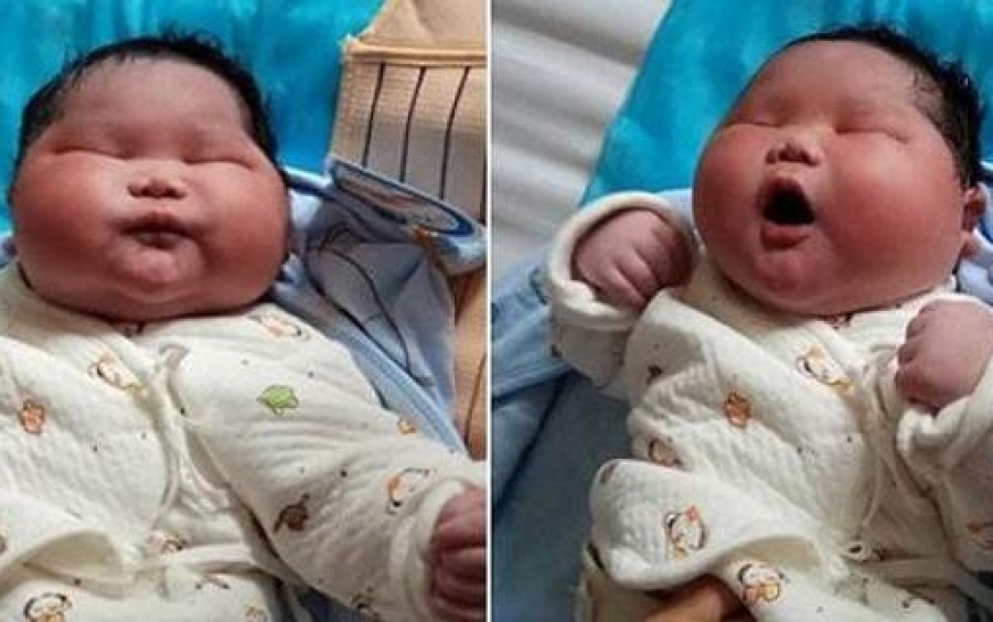 Viral το μωρό στην Κίνα που γεννήθηκε 7 κιλά!
