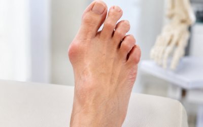 Κότσι και σφυροδακτυλία: Σύγχρονες λύσεις για άνετη βάδιση