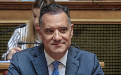 Σε μεταμόσχευση μαλλιών υποβλήθηκε ο Άδωνις Γεωργιάδης