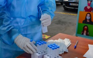 Κορονοϊός: Νέο rapid test αντιγόνου με δείγμα σάλιου