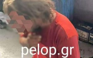 Απάνθρωπες καταστάσεις Πάτρα - Τον ανάγκασαν να πει τα κάλαντα γονατιστός και του έβαλαν φωτιά! (εικόνες)