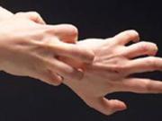 Οδηγίες για την καταπολέμιση ψύλλων