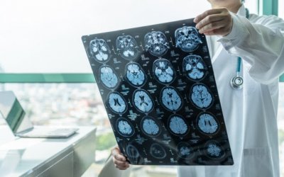 Τζανάκης: Δεκάδες προβλήματα υγείας που προκαλούν θρομβώσεις και δεν σχετίζονται με τα εμβόλια